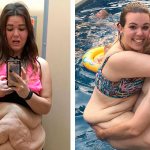 10 девушек которые показали что происходит с телом после похудения