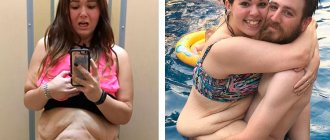 10 girls who showed what happens to the body after losing weight