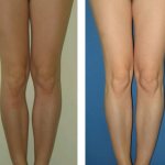 How to make your legs more beautiful