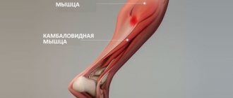 Soleus muscle. Where is it located, functions, anatomy, pain, causes, treatment 