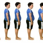 stages of obesity in adolescents