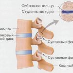 Spine structure